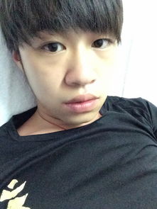 本人头发少额头高发际线也高想烫发适合什么发型下面是我以前的发型