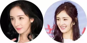 杨幂 baby都踩了这个雷区 脱发 发际线后移该怎么办