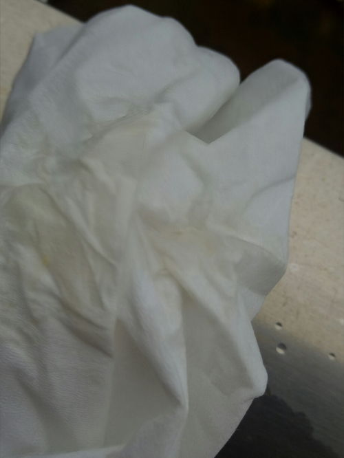 现孕6周,昨天拖地时感觉动了一下,然后下体流了图片上的颜色液体,当时的措施是马上在床上躺了,今早有些量不多如图,这情况是 同时该如何是好 妈妈帮问答